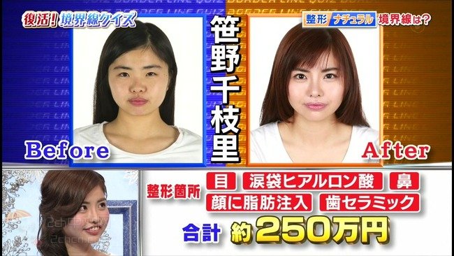 2ch：日本妹子花费250万日元整形成石原里美脸